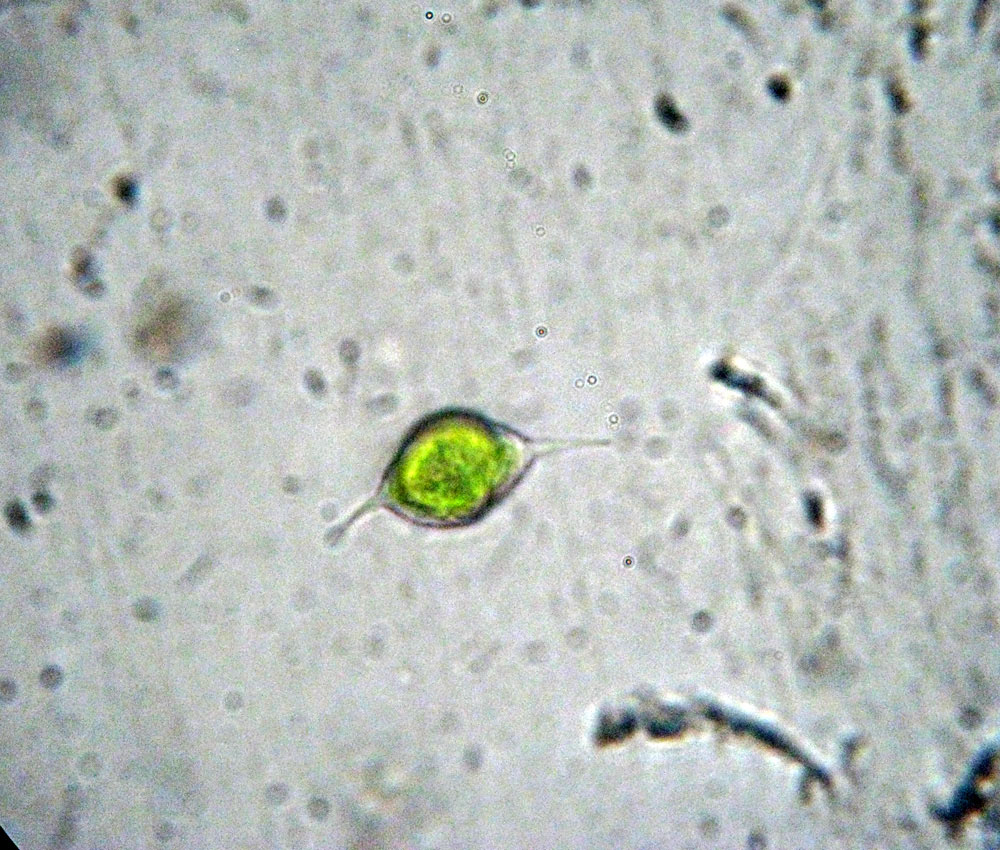 Tetraedron caudatum probabilmente